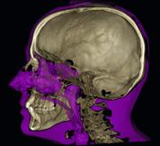 Strumenti eccellenti per immagini di qualità Grazie a un set completo di strumenti per la visualizzazione, l elaborazione, la misurazione, il disegno e le annotazioni delle immagini, Planmeca Romexis