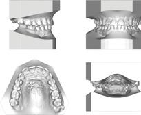 pianificazione dei trattamenti ortodontici in 3D.