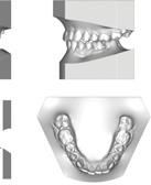 modalità scansione del modello Planmeca ProMax 3D possono essere messe in occlusione con il morso in cera usando