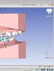 Planmeca PlanScan Pianificazione del trattamento in 3D In Planmeca Romexis 3D Ortho Studio è possibile