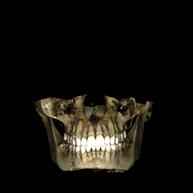 Combinazione 3D esclusiva Foto del viso 3D Confronti pre e post-operatorio Planmeca ProFace è un esclusivo sistema fotografico del viso 3D