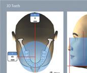 Supporto per il paziente impareggiabile Posizionamento accessibile del paziente Posizionamento agevole con un architettura anteriore aperta Visuale perfetta del vostro paziente Nessuna sensazione