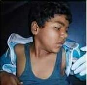 Il bimbo ucciso è: 1.Yihya Ahmed Hemedah, 9 anni. Il bimbo ferito è: 1. Khaled Ahmed Hemedah, 11 anni, ha riportato ferite alla pancia e la sua situazione medica è molto critica.