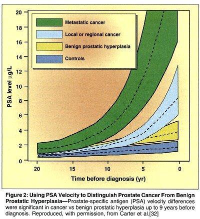 PSA (Prostate Specific Antigen) o callicreina-3 Proteasi a serina,