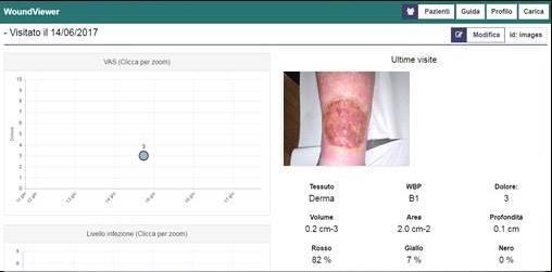 Il sistema Wound Viewer La soluzione mobile Click-and-Go per monitorare al meglio il ciclo di