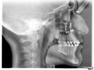 15/18 Imaging medico Risolviamo problemi di ottimizzazione del contrasto, correzione dell esposizione, esaltazione dei particolari