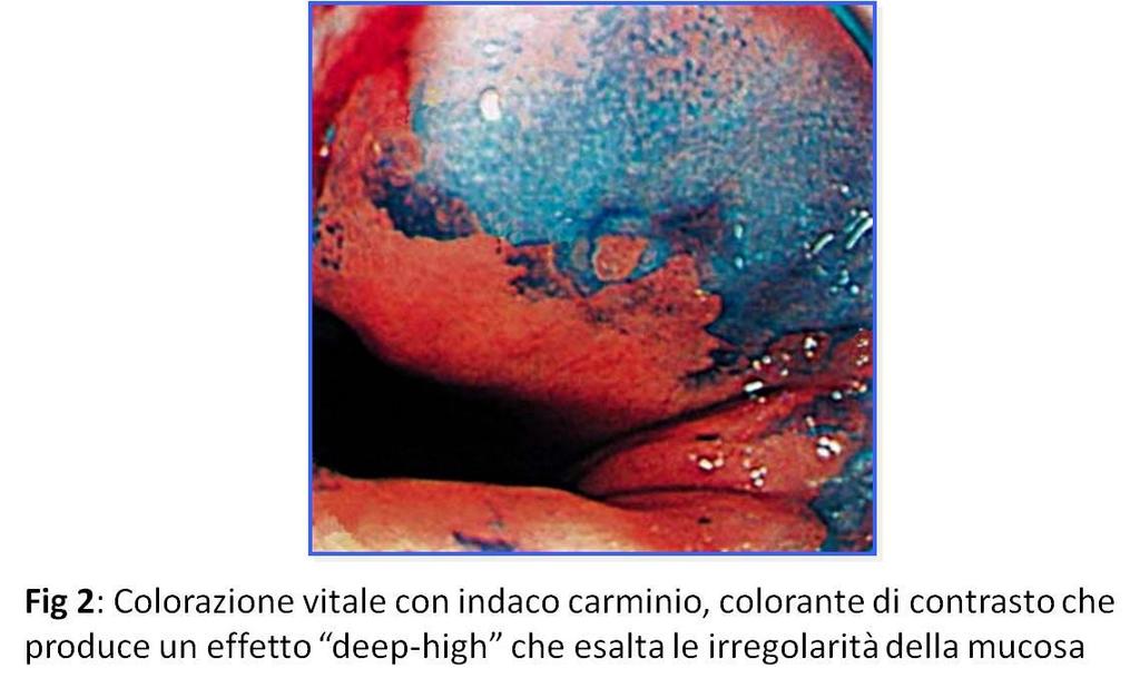 Queste sostanze appartengono a tre classi fondamentali: Coloranti vitali assorbiti dalle cellule per diffusione o assorbimento attivo ( liquido di Lugol, blu di metilene, cristal violetto ) Coloranti