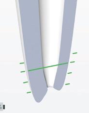 La misurazione elettronica precisa della lunghezza secondo il processo di misurazione a impulsi consente di definire esattamente la lunghezza di preparazione.