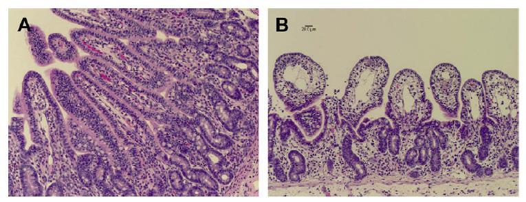 Fisiopatologia Da Pathophysiology of Diarrhea in Calves D.M. Foster, Geof W.