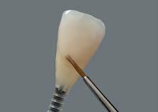 colore del dente preparato. In tal modo è possibile riprodurre il colore in modo più semplice e sicuro.
