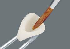 Questo prodotto consente a odontoiatri e odontotecnici di riprodurre il colore del dente in modo più semplice e sicuro, poiché il colore del restauro può essere controllato già in una fase