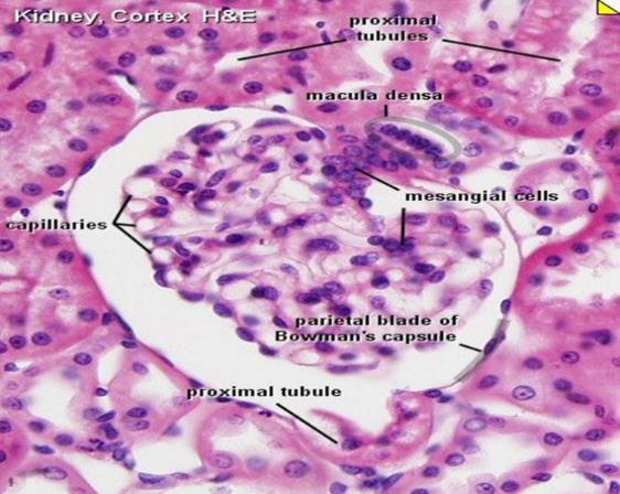 Microscopio ottico Comparto glomerulare: aumento del diametro, l aumento della cellularità, l espansione mesangiale, l ispessimento delle pareti capillari, la