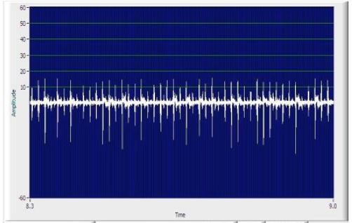 ultrasuoni evidenziano anomalie nei quadri anche se chiusi, ad