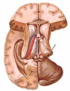 ventricoli laterali