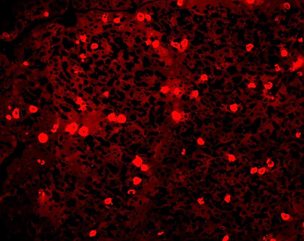 Microcristalli Microscopia ottica: sezione semifine I formaggi extra