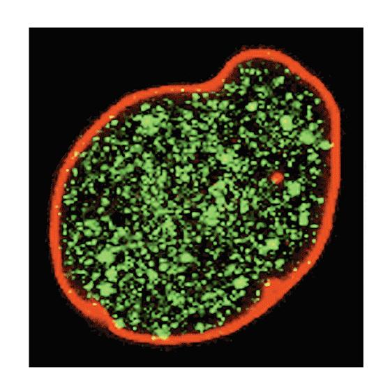 Lamina nucleare Nucleo di una cellula umana in