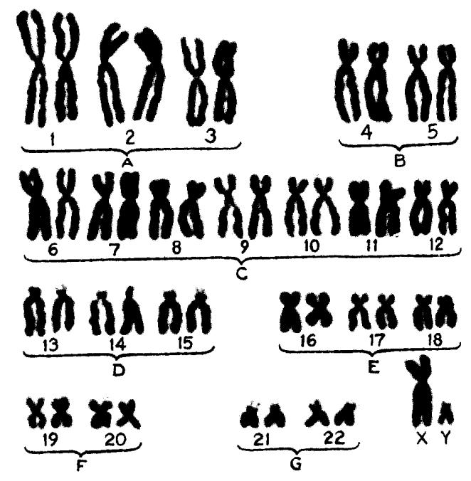 CROMOSOMI E CROMATINA CARIOTIPO: corredo cromosomico caratteristico di ogni specie.