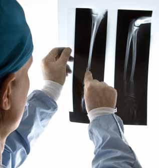 LE TECNICHE Radiologia convenzionale digitalizzata La radiologia convenzionale digitalizzata utilizza i raggi X per ottenere immagini radiografiche a livello di tutto il corpo.