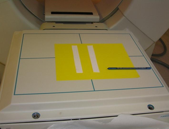 Passaggi operativi (II) Sviluppare la cromatografia fino al raggiungimento da