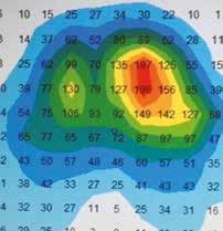 Case History Miglioramenti biomeccanici dovuti al posizionamento centrale del comando nelle carrozzine elettroniche.