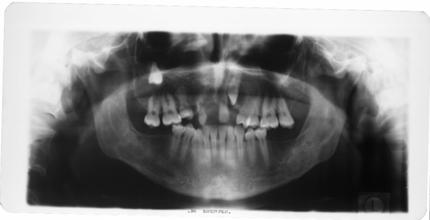 ESAMI RADIOGRAFICI