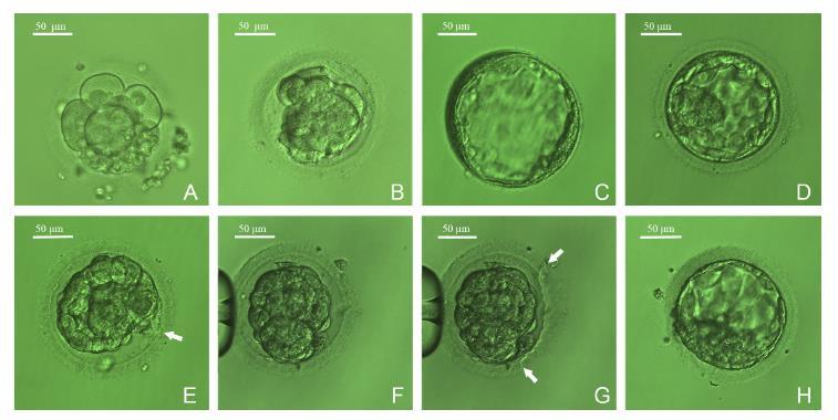 ASSISTED HATCHING Studio prospettivo randomizzato FROZEN EMBRYO TRANSFER Wan et al.