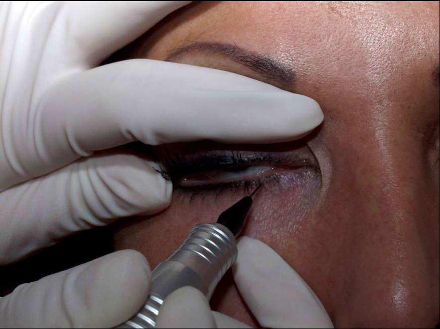 Micropigmentazione eyeliner e infraciliare Una linea interna al contorno occhi per dare