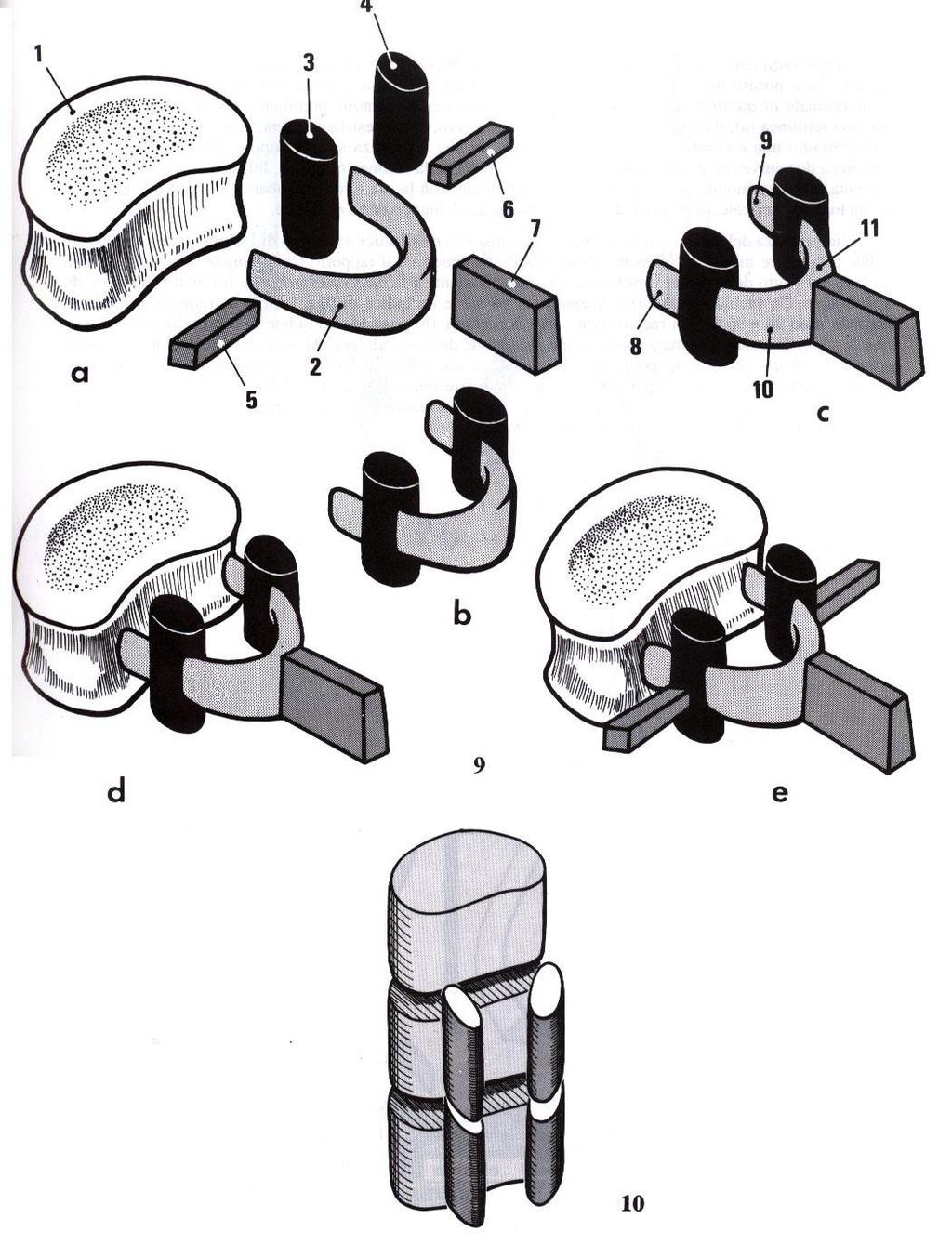 1 Struttura di una Vertebra tipo 4 3 9 6 7 11 1. corpo vertebrale 5 2 8 10 2. arco vertebrale 3. processi articolari 4. Processi articolari 1 2 1 5.