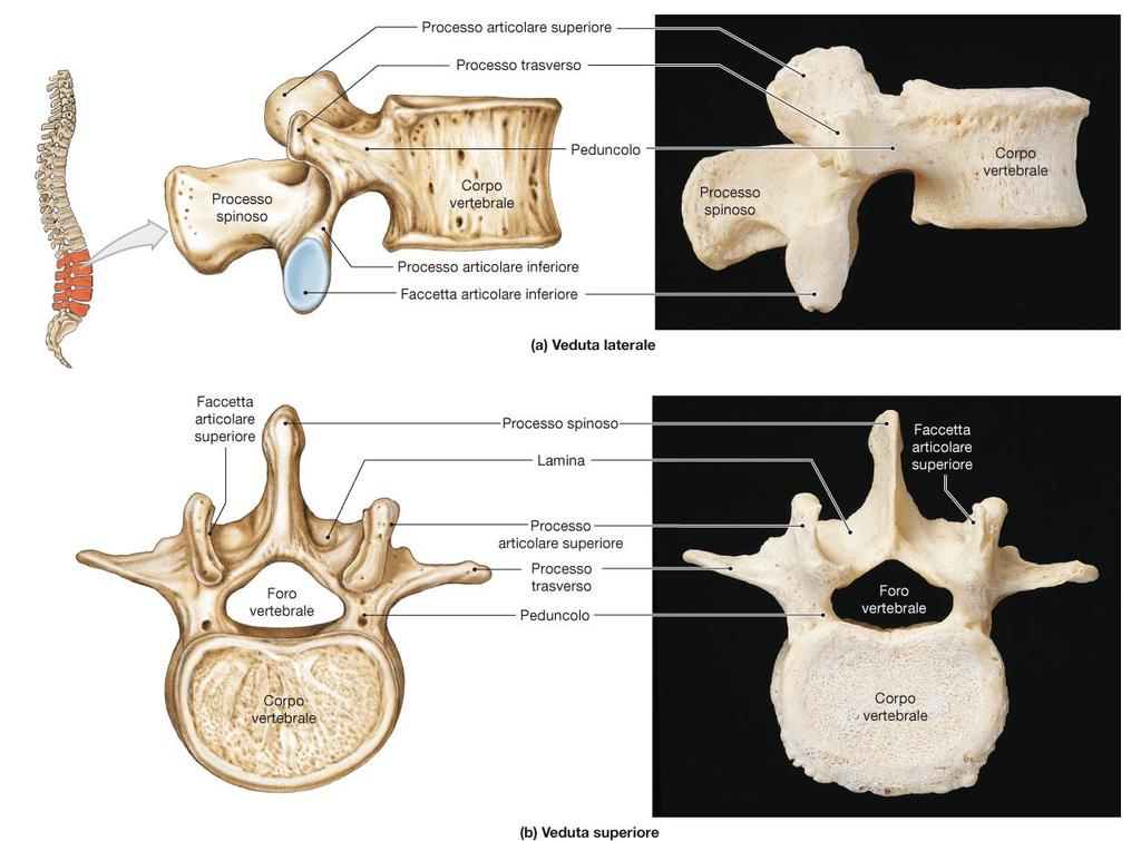 Vertebre LOMBARI Processo costiforme