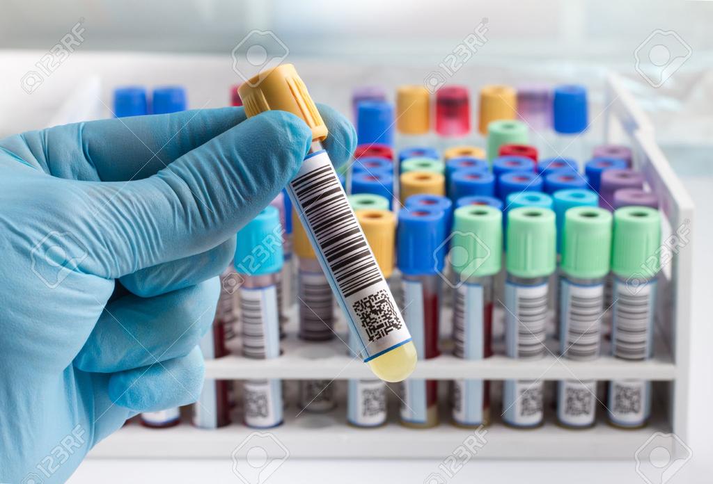Test Lymphocyte transformation test Svantaggi dei test in vitro