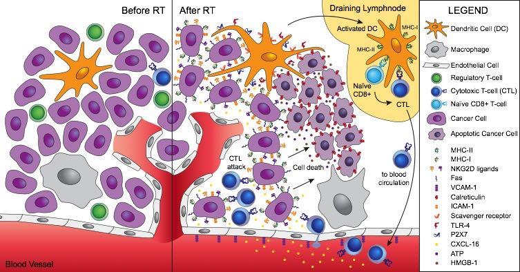 Radiotherapy modifies the immune