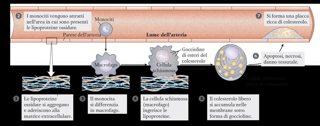 Eccesso di LDL in