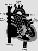 Qualità di vita post Correzione Anatomica Quasi totalità dei soggetti (95%) in I classe NYHA (pienamente attivi/senza limitazione) Test da sforzo: 94 % normale capacità esercizio Buona qualità di