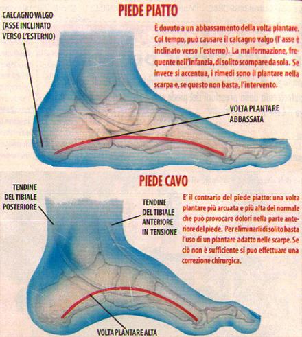 delle capacità rigenerative del bambino, che non sono quelle dell adulto. Quindi riforma subito l emitendine mancante. Piede talo-valgo Opposto al piede equino-varo-addotto-supinato.