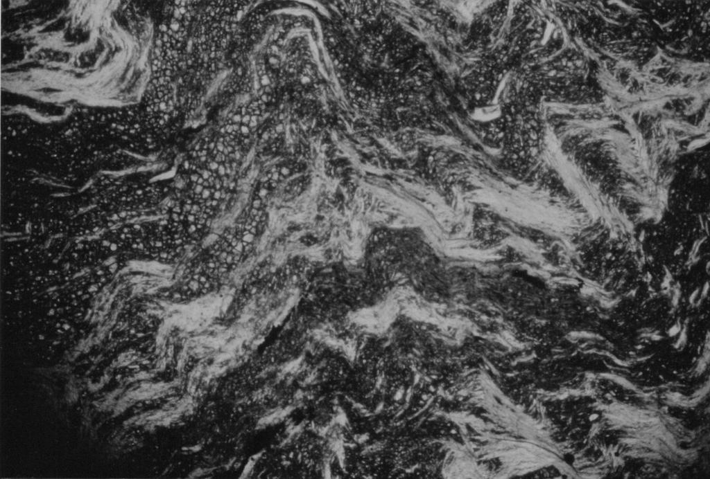 Lherzolite Lherzolite milonite serpentinizzata Unità Voltri (Acquasanta, Punta Martin): la sezione sottile mostra l accrescimento di serpentino ai danni della mesostasi ad