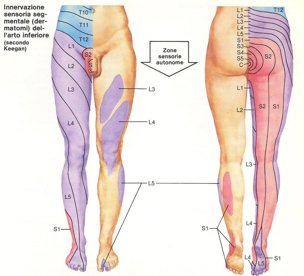 radicolopatie arti inferiori (sensibilità): ad esempio