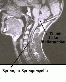 centromidollare