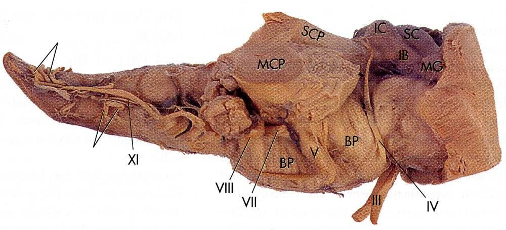 MG: nucleo genicolato mediale IB: braccio del collicolo inferiore IC: collicolo inferiore SC: collicolo superiore BP: parte