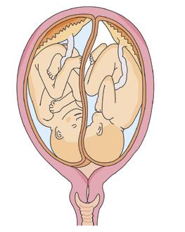 Anatomia e fisiologia del corpo umano I fattori di rischio del parto Parto multiplo Con il termine di gravidanza multipla si intende lo sviluppo contemporaneo di due o più feti.