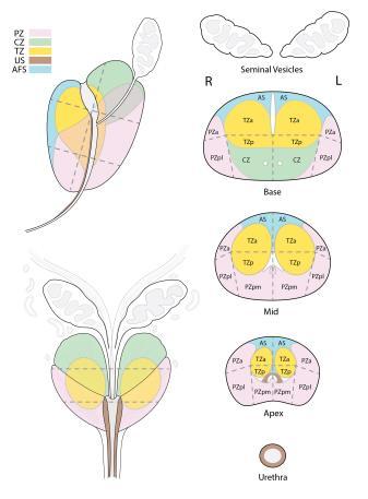 Biopsia cognitiva Prelievi aggiuntivi allo