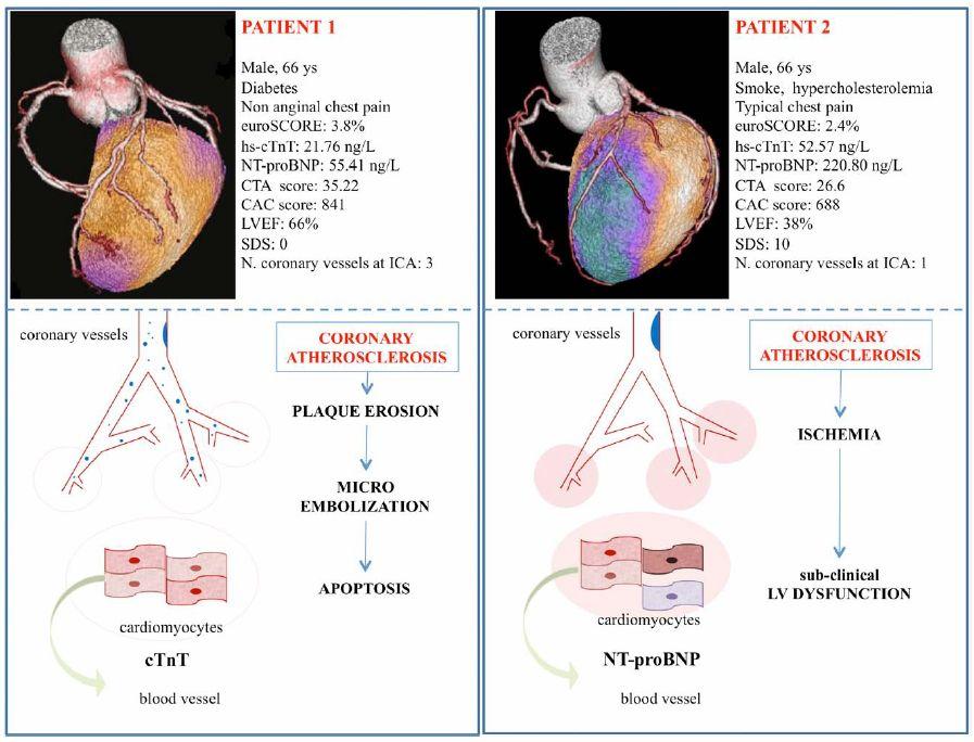 Better Predictive Models of CAD Biomarkers to Predict