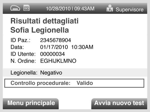 Lo schermo del Sofia visualizzerà i risultati del controllo procedurale come valido o non valido e fornirà un risultato positivo o negativo per il rilevamento della Legionella pneumophila di
