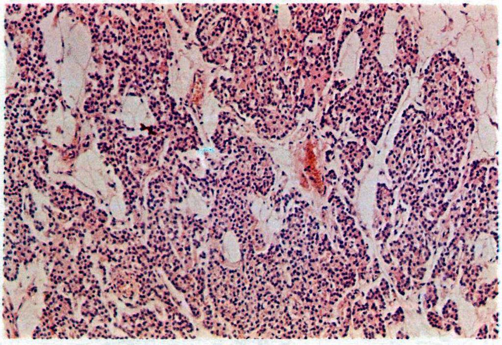 PARATIROIDI Micro-anatomia: parenchima epiteliale cordonale o a cluster rappresentanti cellulari: cellule principali (uniche nella vita postnatale)