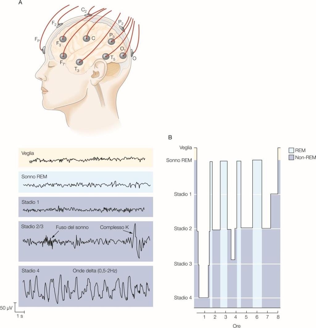 Fasi Del Sonno Figura 51-1 L attività elettrica cerebrale ha caratteristiche