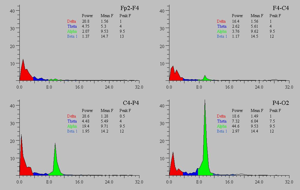 fase per ciascuna delle frequenze delle onde componenti.