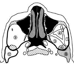 pterigoideo esterno, 4 m. temporale, 5 mandibola, 6 muscolo milojoideo, 7 gh. sottomandibolare, 8 gh.