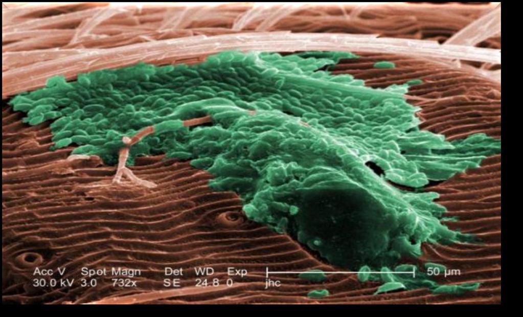 biofilm microcolonie di cellule microbiche su superfici organiche o inorganiche, immerse in una matrice polisaccaridica extracellulare ( slime ) da loro