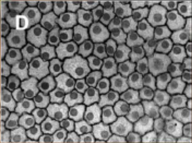 Clusters(estrema periferia) Due o tre strati di cellule tra i corpi di