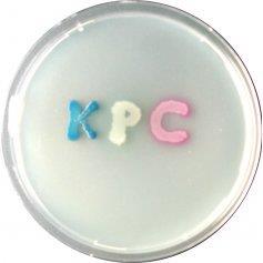 KPC (Klebsiella pneumoniae 1 isolamento nel 1996, USA KPC sono b-lattamasi di classe A carbapenemasi) Il gene blakpc gene è localizzato su un plasmide, all interno di un trasposone (Tn4401) che ne