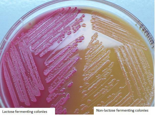 Enterobacteriaceae (the family) BATTERI DI GRANDE IMPATTO EPIDEMIOLOGICO Tra i Gram negativi, i batteri della famiglia Enterobacteriaceae